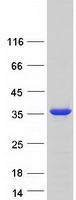SNAP29 Protein - Purified recombinant protein SNAP29 was analyzed by SDS-PAGE gel and Coomassie Blue Staining