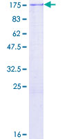 SNAP91 / AP180 Protein - 12.5% SDS-PAGE of human SNAP91 stained with Coomassie Blue