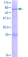 SNAPC1 Protein - 12.5% SDS-PAGE of human SNAPC1 stained with Coomassie Blue
