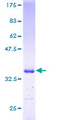 SNAPC5 Protein - 12.5% SDS-PAGE of human SNAPC5 stained with Coomassie Blue