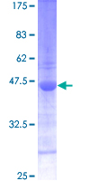 SNAPIN Protein - 12.5% SDS-PAGE of human SNAPAP stained with Coomassie Blue