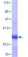 SNAPIN Protein - 12.5% SDS-PAGE Stained with Coomassie Blue.