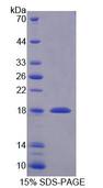 SNAPIN Protein - Recombinant SNAP Associated Protein By SDS-PAGE