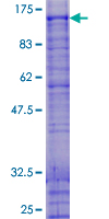 SNARK / NUAK2 Protein - 12.5% SDS-PAGE of human NUAK2 stained with Coomassie Blue