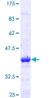 SNCA / Alpha-Synuclein Protein - 12.5% SDS-PAGE of human SNCA stained with Coomassie Blue