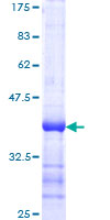 SNCA / Alpha-Synuclein Protein - 12.5% SDS-PAGE Stained with Coomassie Blue.