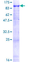 SNCAIP / Synphilin 1 Protein - 12.5% SDS-PAGE of human SNCAIP stained with Coomassie Blue