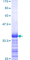 SNCAIP / Synphilin 1 Protein - 12.5% SDS-PAGE Stained with Coomassie Blue.