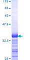 SNCAIP / Synphilin 1 Protein - 12.5% SDS-PAGE Stained with Coomassie Blue.