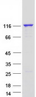 SNCAIP / Synphilin 1 Protein - Purified recombinant protein SNCAIP was analyzed by SDS-PAGE gel and Coomassie Blue Staining