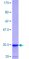 SNCB / Beta-Synuclein Protein - 12.5% SDS-PAGE Stained with Coomassie Blue.