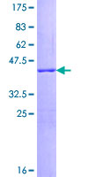 SNCG / Gamma-Synuclein Protein - 12.5% SDS-PAGE of human SNCG stained with Coomassie Blue