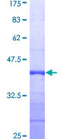 SNCG / Gamma-Synuclein Protein - 12.5% SDS-PAGE Stained with Coomassie Blue.