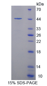 SNCG / Gamma-Synuclein Protein - Recombinant  Synuclein Gamma By SDS-PAGE