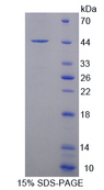 SNCG / Gamma-Synuclein Protein - Recombinant  Synuclein Gamma By SDS-PAGE