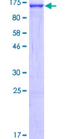 SND1 Protein - 12.5% SDS-PAGE of human SND1 stained with Coomassie Blue