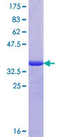 SND1 Protein - 12.5% SDS-PAGE Stained with Coomassie Blue.