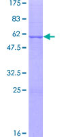SNF8 / EAP30 Protein - 12.5% SDS-PAGE of human SNF8 stained with Coomassie Blue