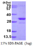 SNF8 / EAP30 Protein
