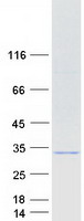 SNF8 / EAP30 Protein - Purified recombinant protein SNF8 was analyzed by SDS-PAGE gel and Coomassie Blue Staining