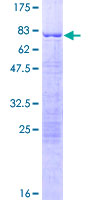 SNIP1 Protein - 12.5% SDS-PAGE of human SNIP1 stained with Coomassie Blue