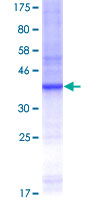SNK / PLK2 Protein - 12.5% SDS-PAGE Stained with Coomassie Blue.
