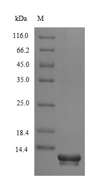 SNPH Protein - (Tris-Glycine gel) Discontinuous SDS-PAGE (reduced) with 5% enrichment gel and 15% separation gel.