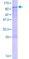 SNPH Protein - 12.5% SDS-PAGE of human SNPH stained with Coomassie Blue