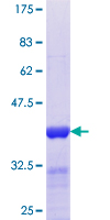 SNPH Protein - 12.5% SDS-PAGE Stained with Coomassie Blue.