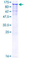 SNRK Protein - 12.5% SDS-PAGE of human SNRK stained with Coomassie Blue