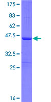 SNRNP25 Protein - 12.5% SDS-PAGE of human C16orf33 stained with Coomassie Blue