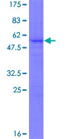 SNRNP27 Protein - 12.5% SDS-PAGE of human RY1 stained with Coomassie Blue