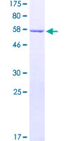 SNRNP35 Protein - 12.5% SDS-PAGE of human SNRNP35 stained with Coomassie Blue