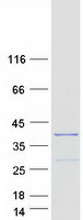 SNRNP35 Protein - Purified recombinant protein SNRNP35 was analyzed by SDS-PAGE gel and Coomassie Blue Staining