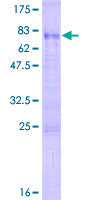SNRNP48 Protein - 12.5% SDS-PAGE of human C6orf151 stained with Coomassie Blue