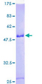 SNRP70 / SNRNP70 Protein - 12.5% SDS-PAGE of human SNRP70 stained with Coomassie Blue