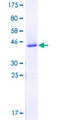 SNRP70 / SNRNP70 Protein - 12.5% SDS-PAGE Stained with Coomassie Blue.