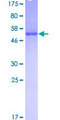 SNRPA / U1A Protein - 12.5% SDS-PAGE of human SNRPA stained with Coomassie Blue