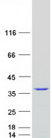 SNRPA / U1A Protein - Purified recombinant protein SNRPA was analyzed by SDS-PAGE gel and Coomassie Blue Staining