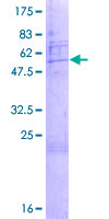 SNRPA1 Protein - 12.5% SDS-PAGE of human SNRPA1 stained with Coomassie Blue