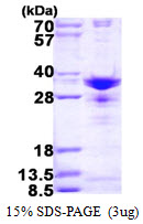 SNRPA1 Protein