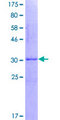 SNRPB / COD Protein - 12.5% SDS-PAGE Stained with Coomassie Blue.