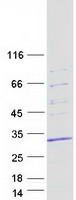 SNRPB / COD Protein - Purified recombinant protein SNRPB was analyzed by SDS-PAGE gel and Coomassie Blue Staining