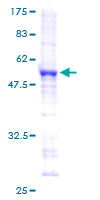 SNRPB2 Protein - 12.5% SDS-PAGE of human SNRPB2 stained with Coomassie Blue