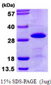 SNRPB2 Protein