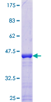 SNRPC / U1C Protein - 12.5% SDS-PAGE of human SNRPC stained with Coomassie Blue