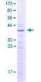 SNRPD1 / SMD1 Protein - 12.5% SDS-PAGE of human SNRPD1 stained with Coomassie Blue