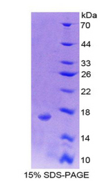 SNRPD1 / SMD1 Protein - Recombinant Small Nuclear Ribonucleoprotein Polypeptide D1 By SDS-PAGE
