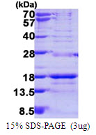SNRPD3 Protein
