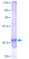 SNRPG Protein - 12.5% SDS-PAGE of human SNRPG stained with Coomassie Blue